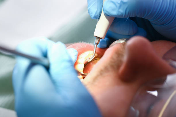 Best Emergency Root Canal Therapy in Serenada, TX